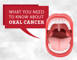 Oral Cancer